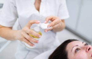 化學換膚