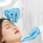 【埋線隆鼻全解析】埋線隆鼻原理、效果＆不可忽視的鼻子埋線缺點