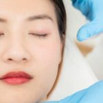 【吊線雙眼皮全攻略】吊線雙眼皮原理、維持時間＆失敗原因